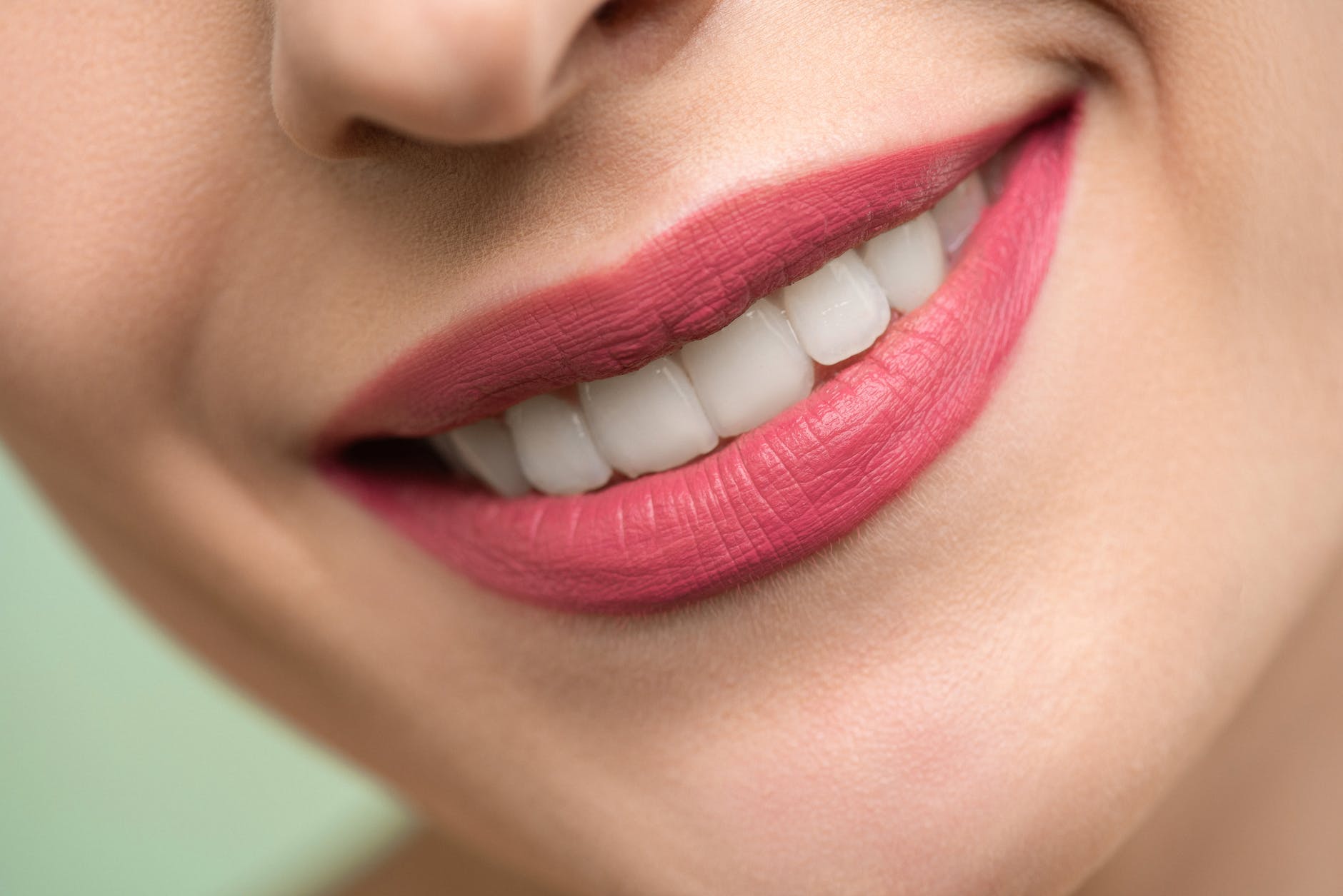 The price of a smile