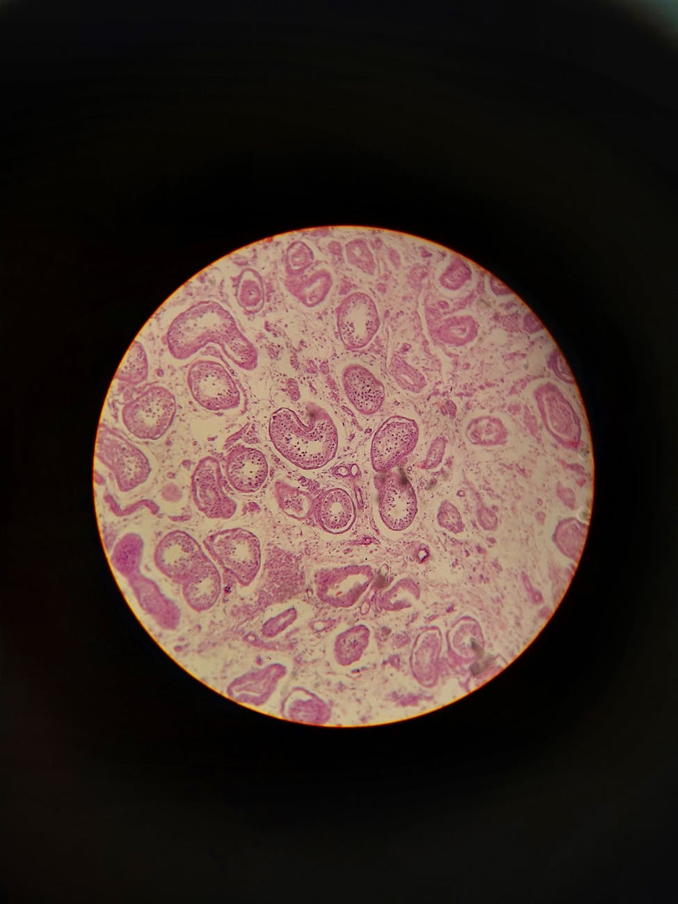 particles seen under a microscope